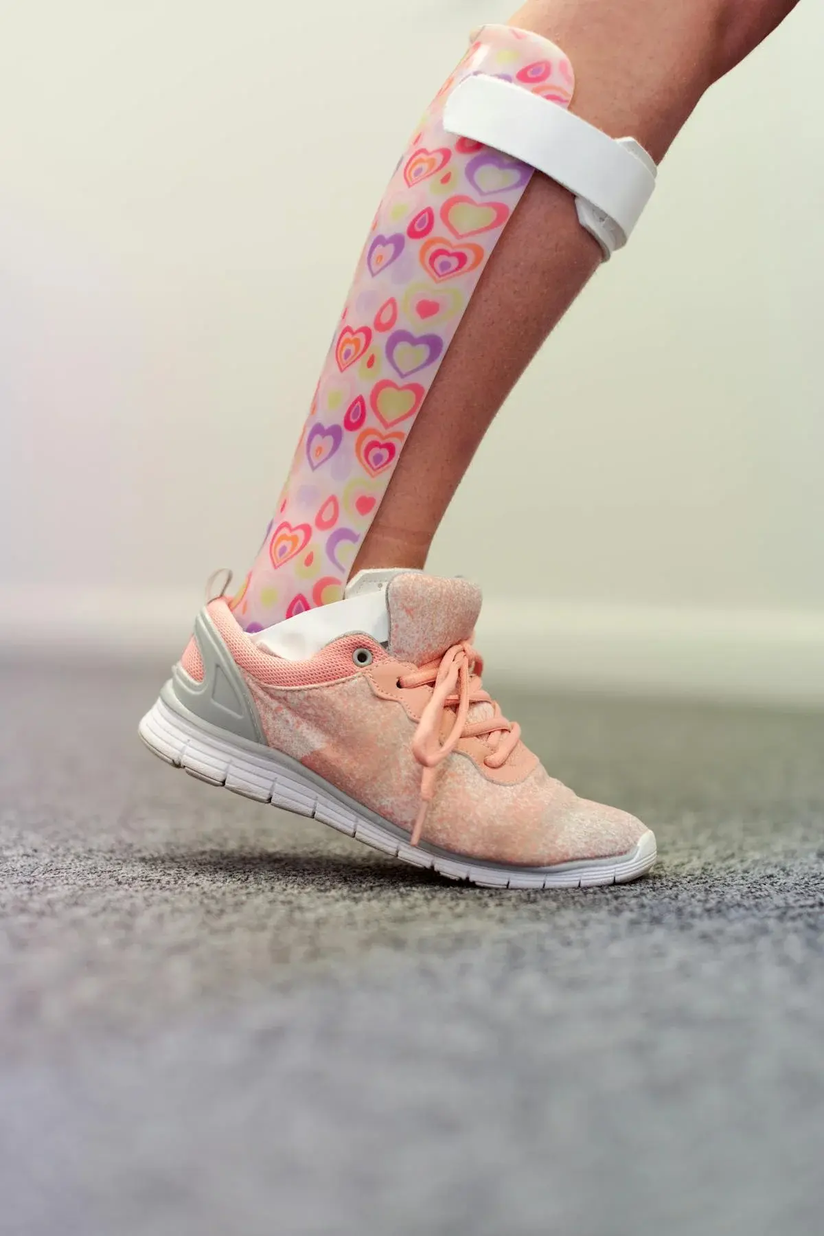 A child wearing a colourful custom ankle-foot orthosis on their lower leg, shown wearing a sneaker