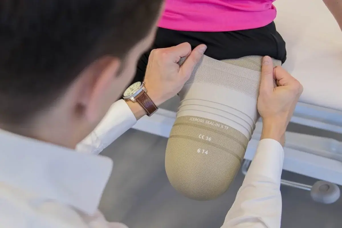 What Does a Prosthetic Liner Do? Understanding Your Most Important Interface