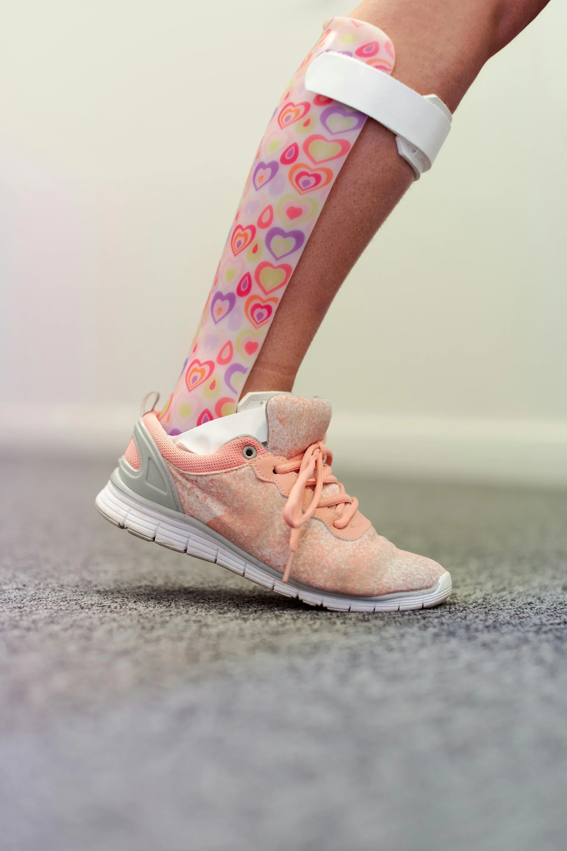 AFOs improving gait efficiency